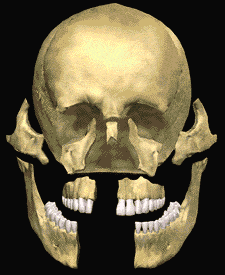 Facial Trauma can affect the structures that support the face